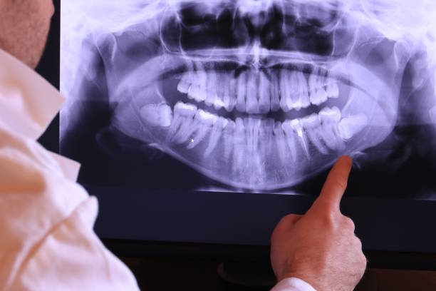 Best Pediatric Emergency Dentist in Cutchogue, NY