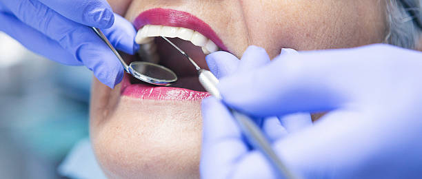Best Broken or Cracked Tooth Emergency Dentist in Cutchogue, NY